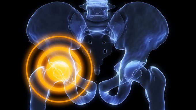 Hip Pain: Common Causes